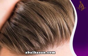 زراعة الشعر بیو فایبر في ايران