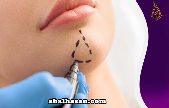 عمليات تجميل الذقن طهران