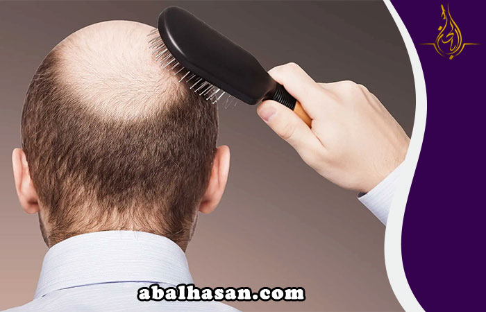 زراعة الشعر في تبريز